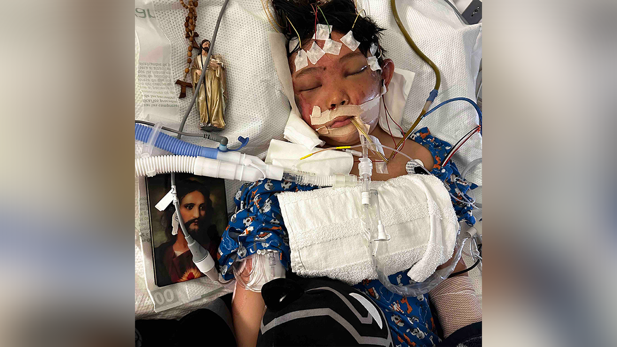 Las Vegas boy, 11, lost his face after being hit by truck while cycling to school